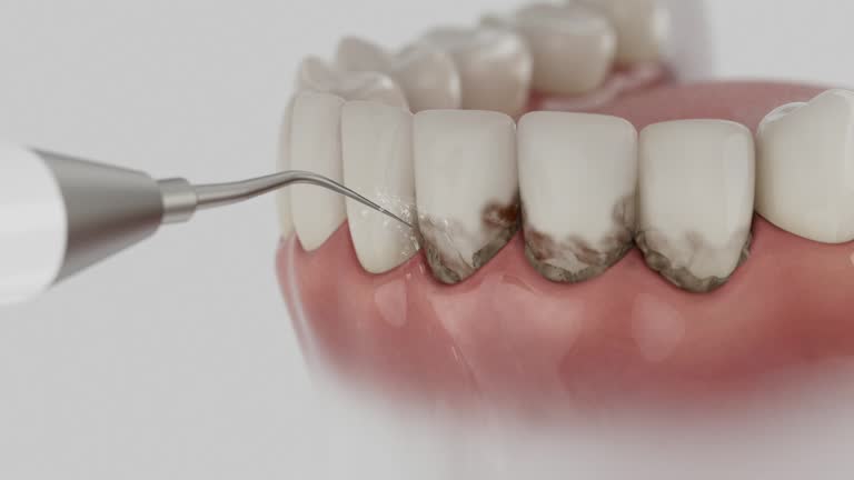 Reliable Dental contractor in Leonardo, NJ by Smile Center Dentistry